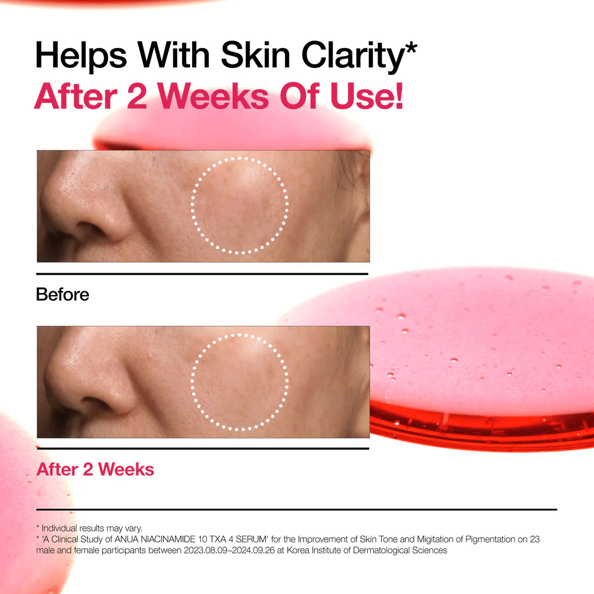 ANUA Niacinamide 10 + Tax 4 Serum سيروم النياسينمايد من انوا