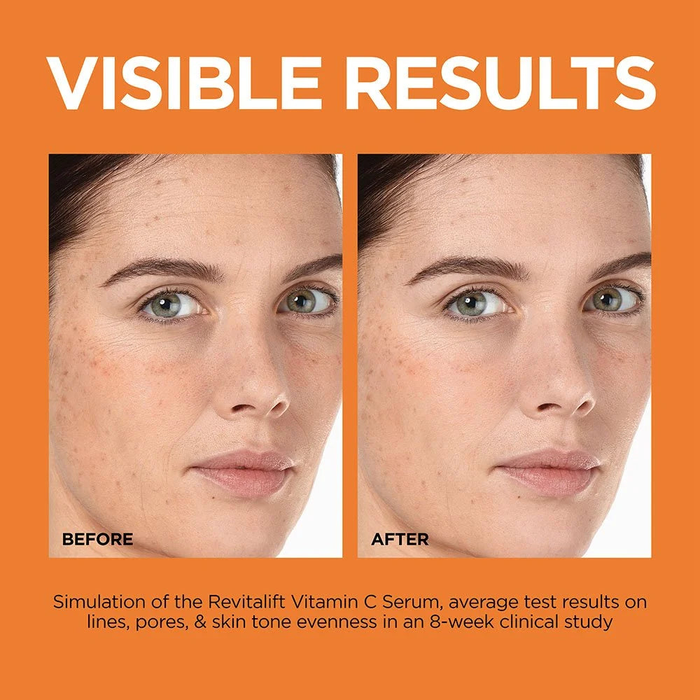 LOREAL PARIS Revitalift Derm Intensives 12% Vitamin C + E + Salicylic Acid Serum 30ml