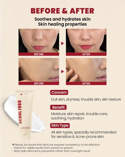 K SECRET SEOUL 1988 Cream Snail Mucin 93% + Rice كريم الحلزون و الارز من كي سيكرت