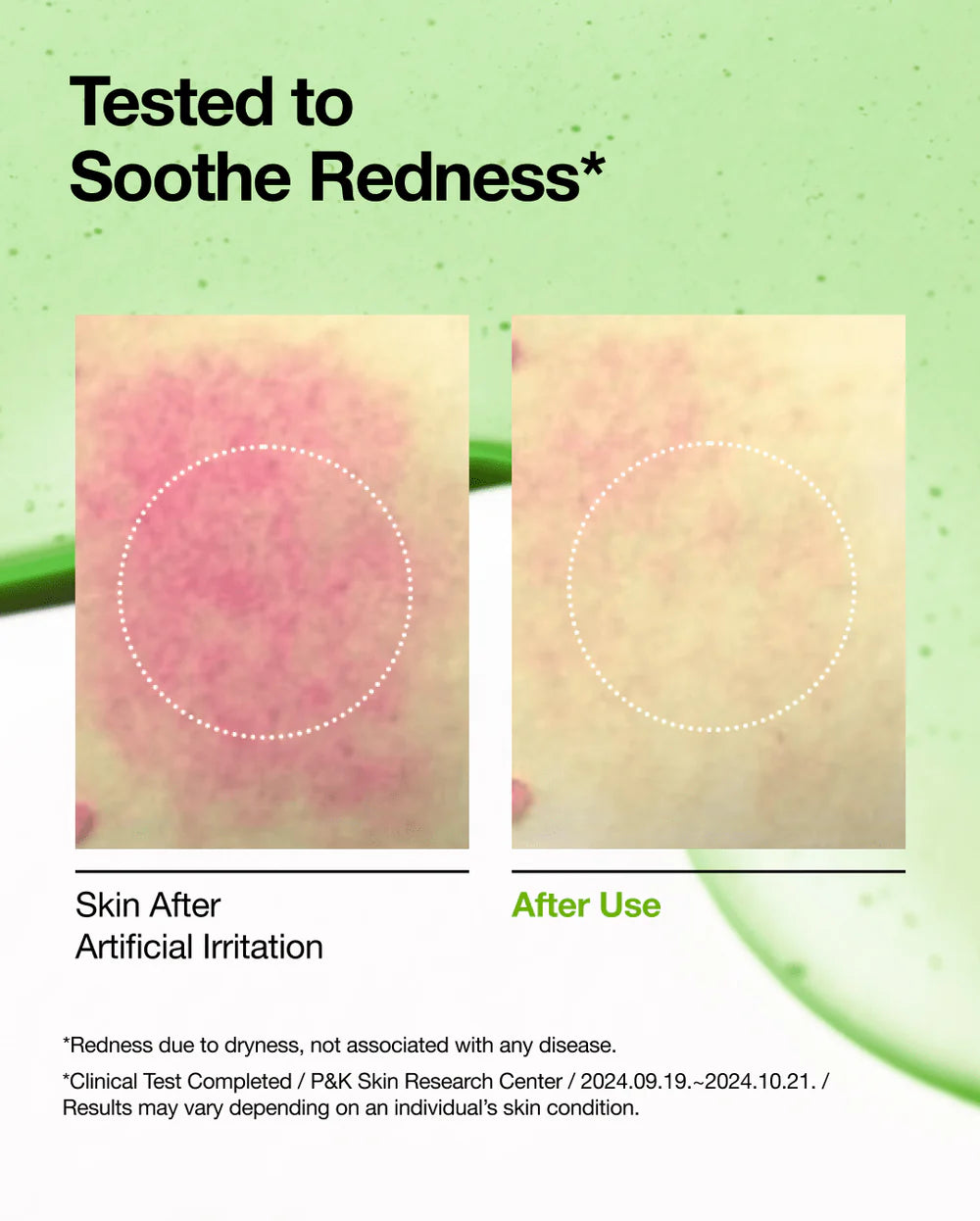ANUA 10 ANUA AZELAIC ACID 10 HYALURON REDNESS SOOTHING SERUM سيروم التهدئة بالازليك اسد من انوا