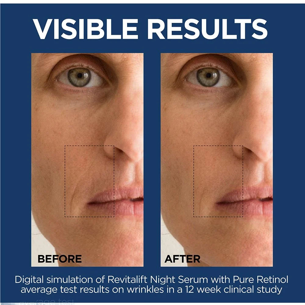LOREAL PARIS Revitalift Derm Intensives Night Serum  سيروم ليلي مع 0.3% ريتينول نقي لتقليل التجاعيد من لوريال