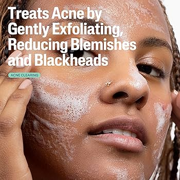 Cetaphil Pore Clearing Acne Cleanser غسول علاج الحبوب من سيتافيل