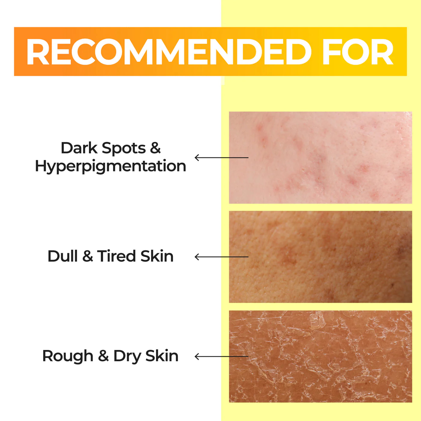 NUMBUZIN No.5 Toner Vitamin Boosting Essence Toner تونر تفتيح البشرة من نمبوزين