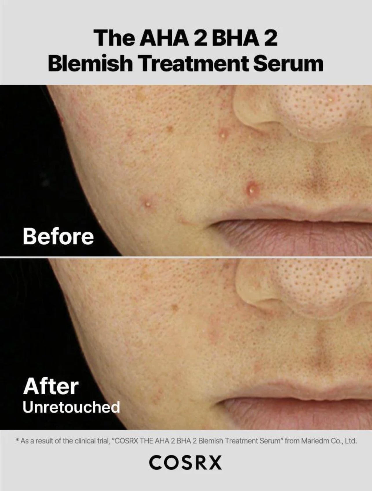 COSRX the AHA 2 BHA 2 Blemish Treatment serum سيروم البشرة المعالج والمقشر من كوزركس