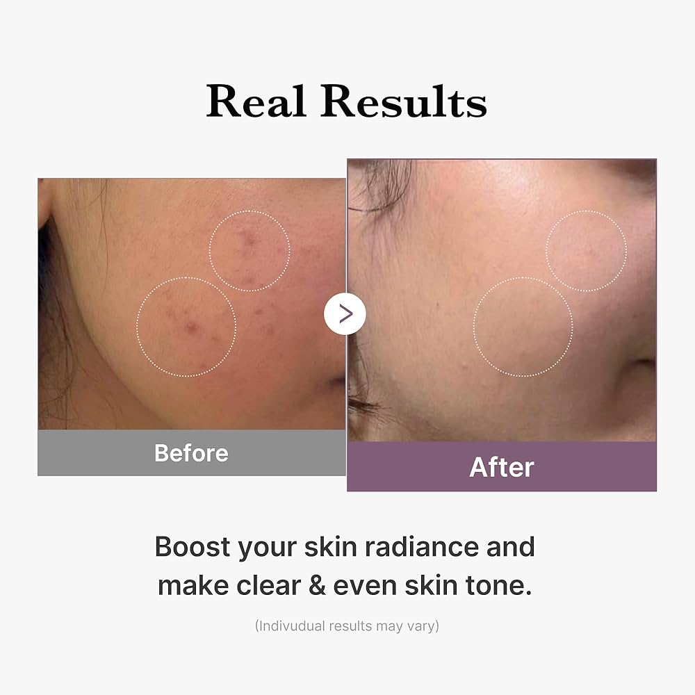 MEDICUBE Age-R Glutathione Glow Toner تونر تعزيز نضارة البشرة من ميديكيوب