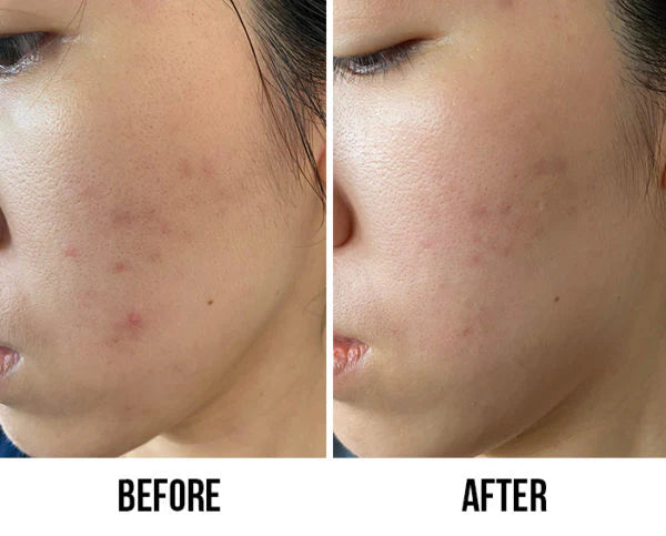 LA ROCH POSAY EFFACLAR
ULTRA CONCENTRATED SERUM
ANTI-IMPERFECTIONS DAILY PEELING سيروم تقشير البشرة من لاروش