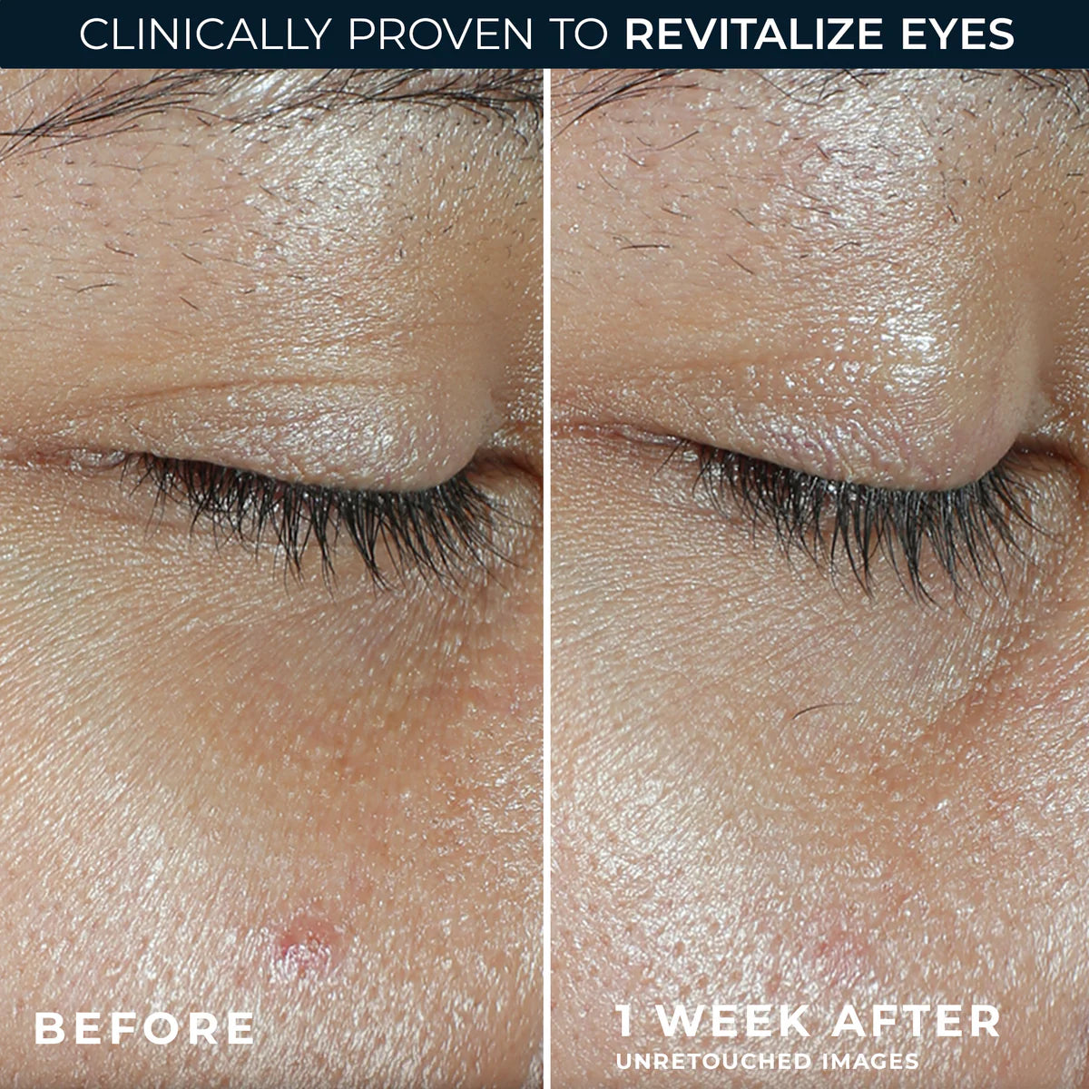 ROC Revive + Glow Vitamin C Eye Balm