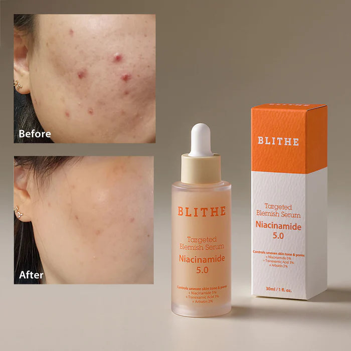 BLITHE Targeted Blinish Serum Niacinamide 5.0 control uneven skin tone & pores سيروم النياسينمايد للبشرة