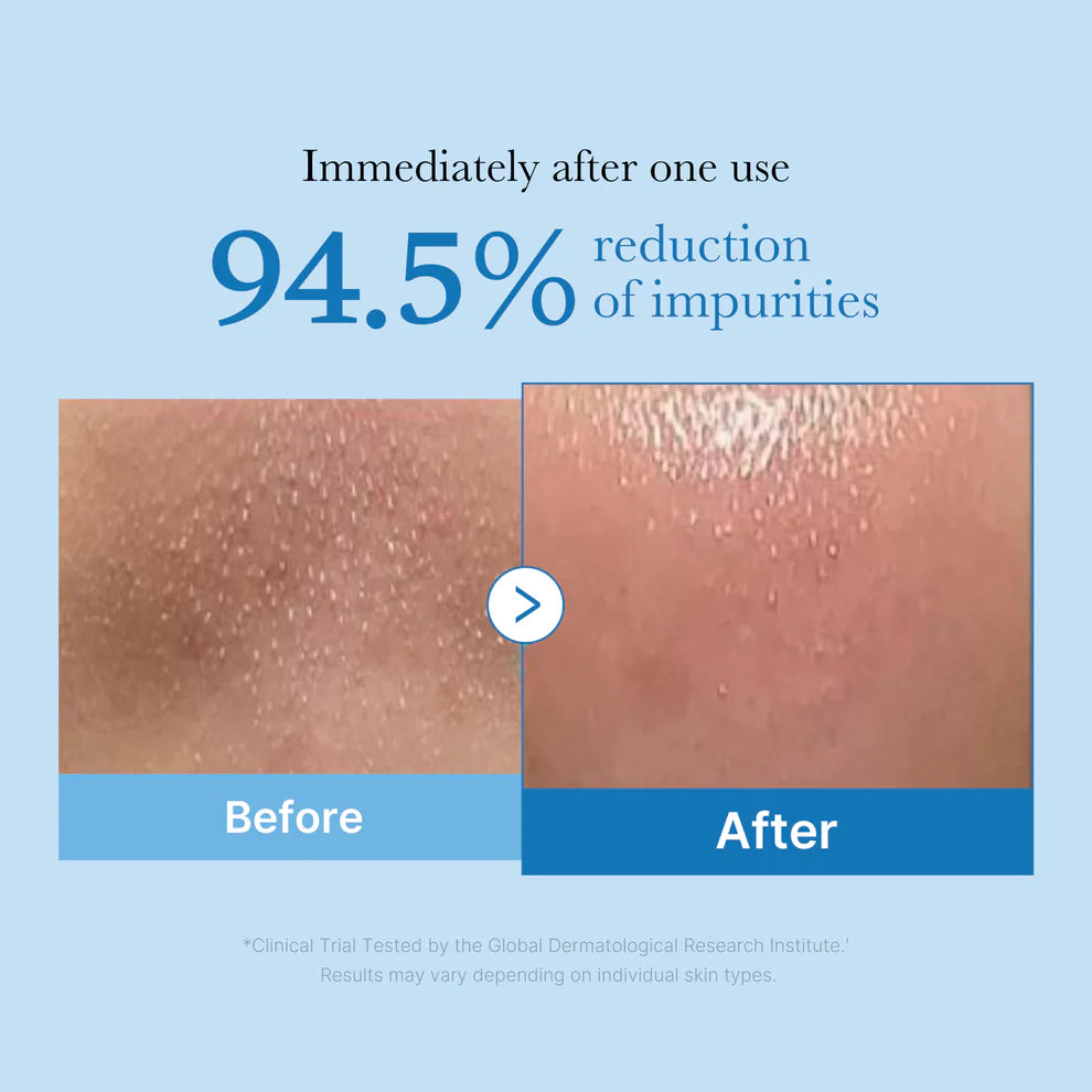 MEDICUBE Zero Pore Blackhead Deep Cleansing Oil غسول زيتي للتنظيف العميق  من ميدكيوب