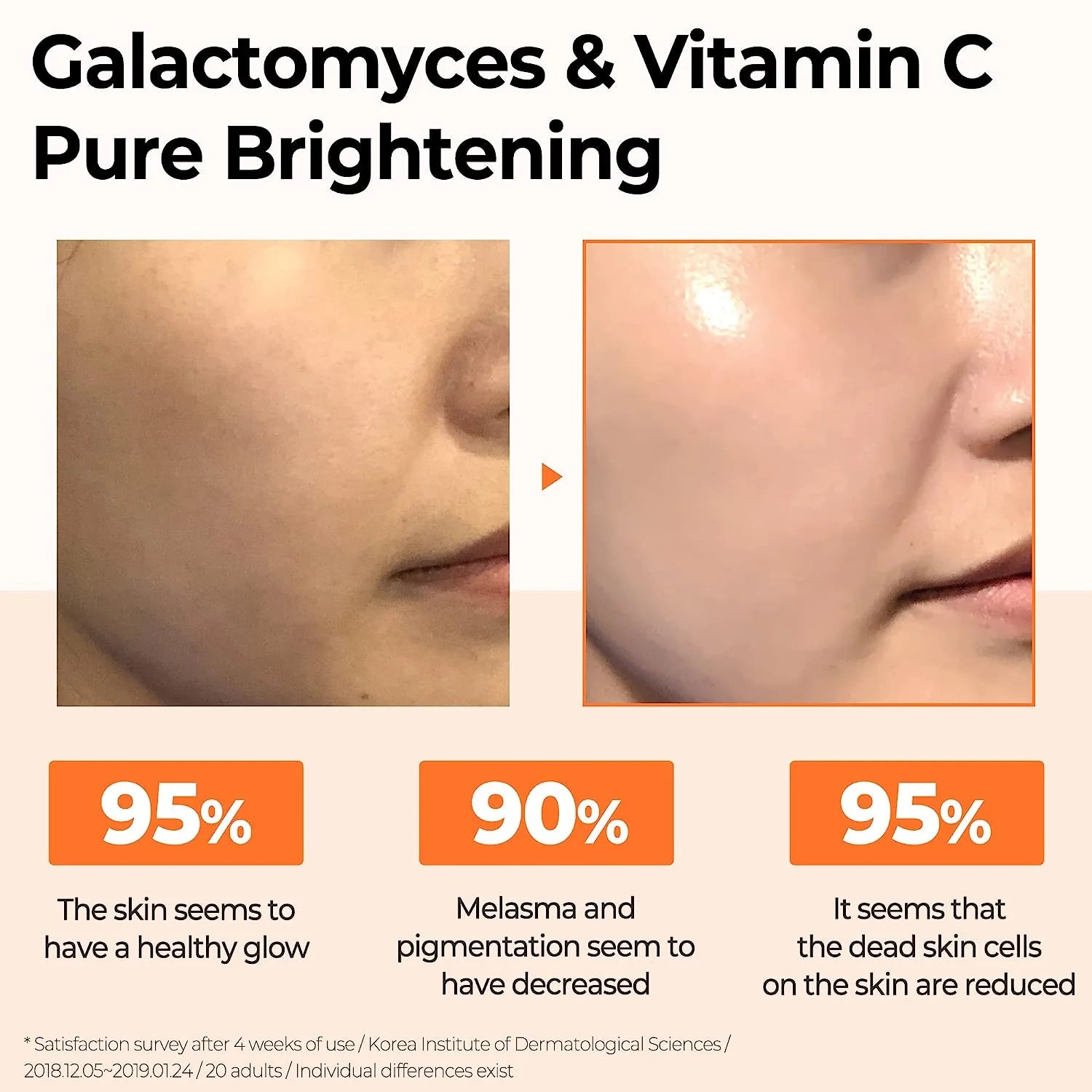 SOME BY MI Galactomyces Pure Vitamin C Glow Toner تونر الفيتامين سي للبشرة