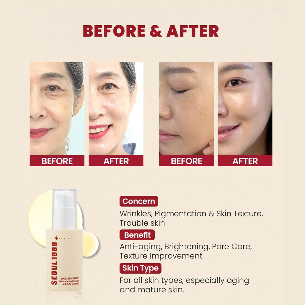 K Secret Seoul 1988 Retinal Serum: 2% Retinal Liposome 2% + Black Ginseng