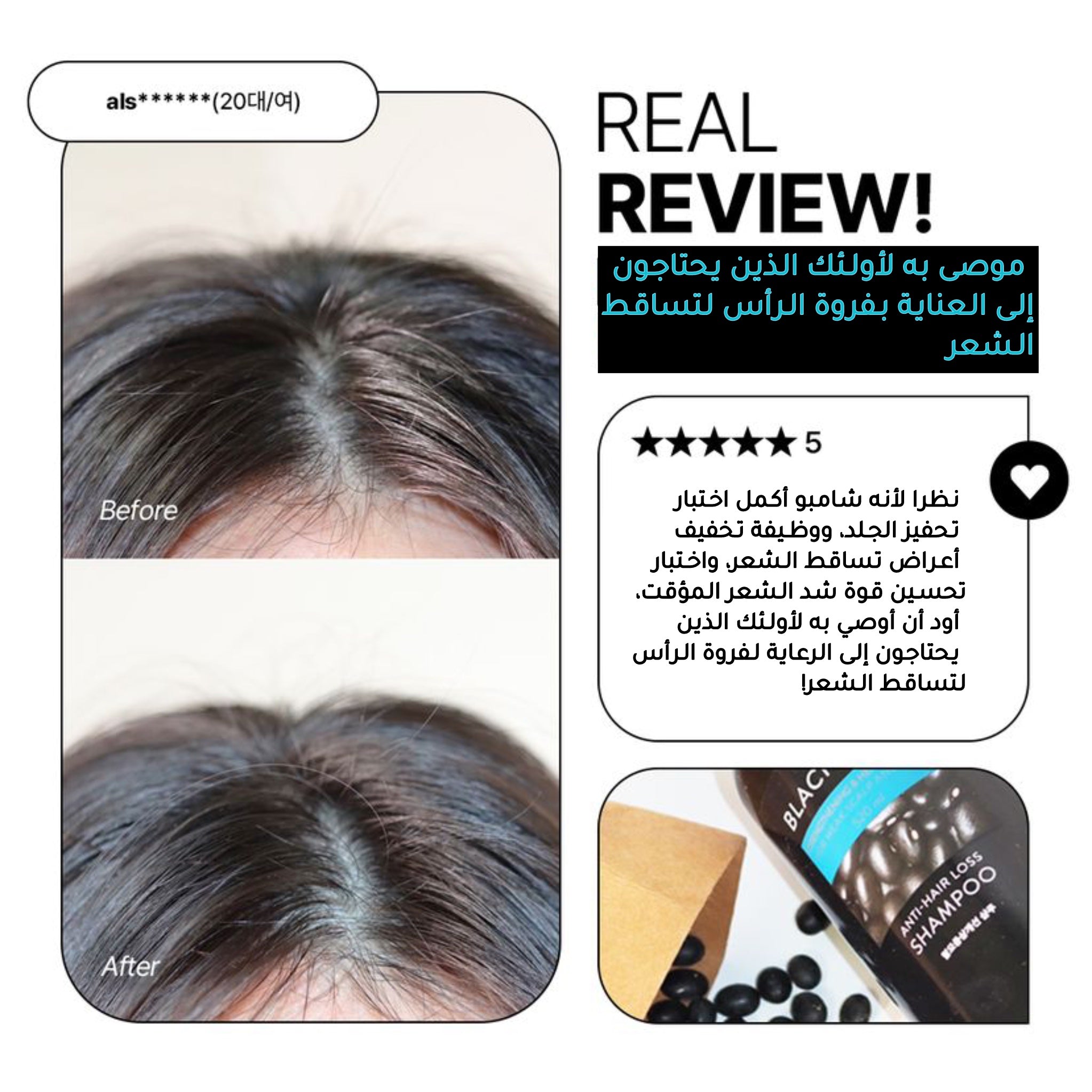 NATURE REPUBLIC Black Bean Anti Hair Loss Shampoo شامبو الفاصوليا السوداء لتساقط الشعر