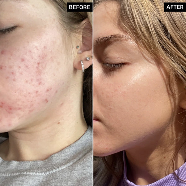 THE INKEY LIST niacinamide serum formulated for all سيروم النياسينمايد ...