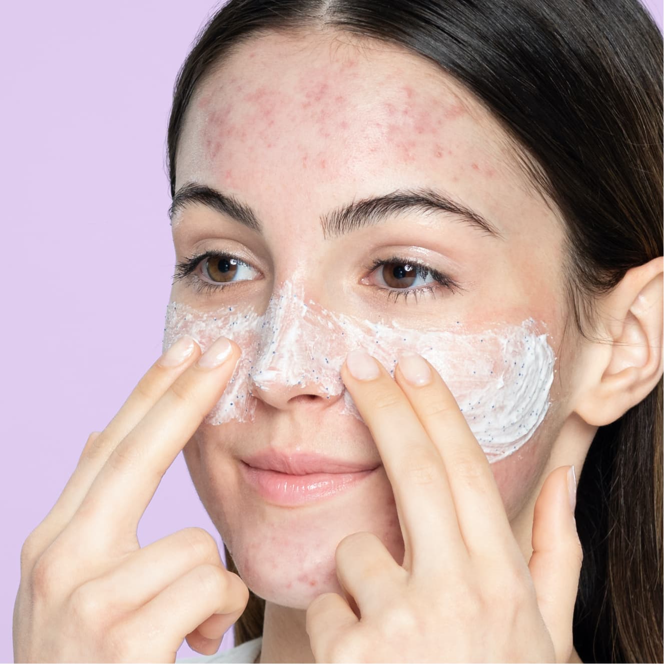 CLEAN & CLEAR blackhead eraser scrub oil free مقشر البشرة لعلاج الرؤوس السوداء من كلين اند كلير