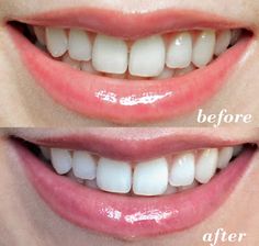 ARM & HAMMER Advance White Extreme Whitening Toothpaste معجون التبييض الفعّال