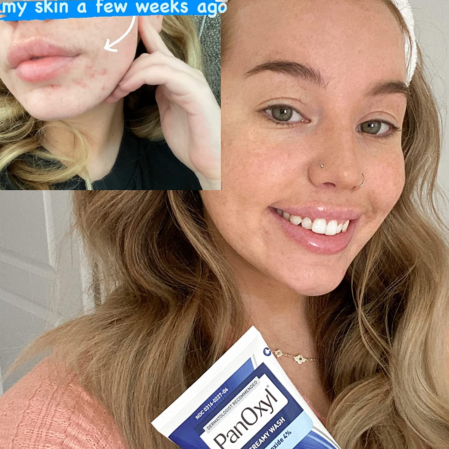 PANOXYL Acne Creamy Wash 4% Benzoyl Peroxide Daily Control