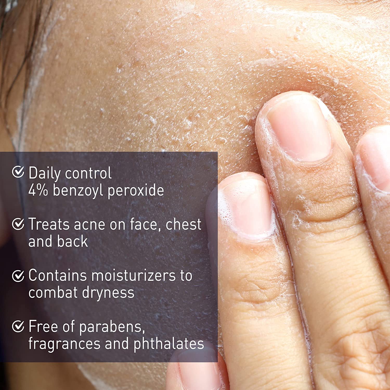 PANOXYL Acne Creamy Wash 4% Benzoyl Peroxide Daily Control