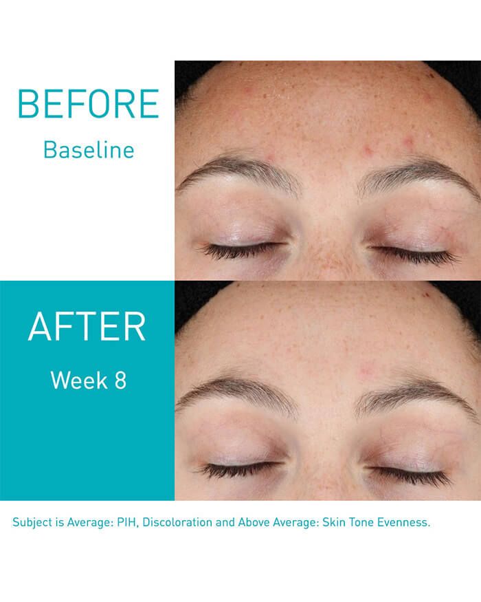 CERAVE Resurfacing Retinol Serum